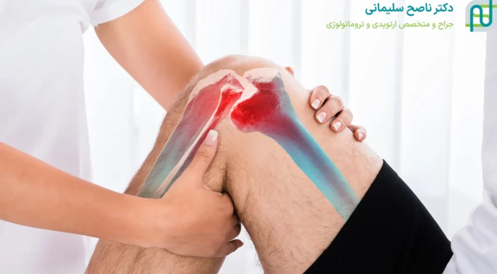 علائم در رفتگی کشکک زانو
