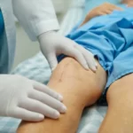 مراقبت بعد از عمل مینیسک زانو