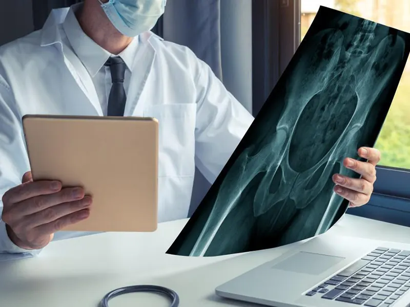 بهترین دکتر فوق تخصص تعویض مفصل لگن سنندج