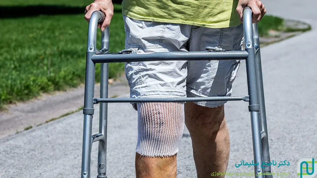 راه رفتن بعد از جراحی تعویض مفصل زانو