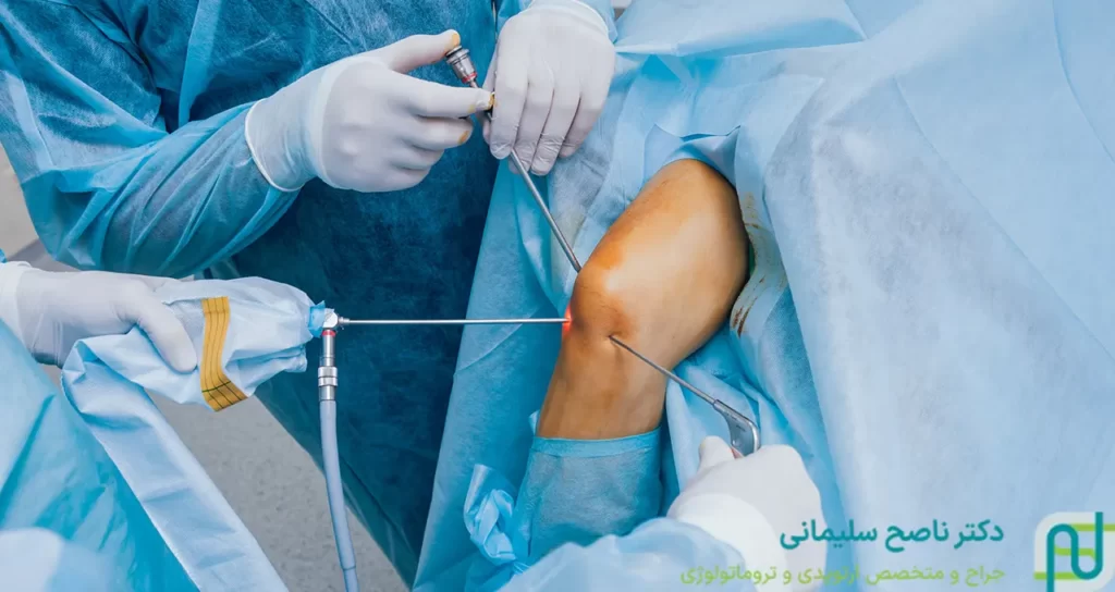آرتروسکوپی زانو در سنندج