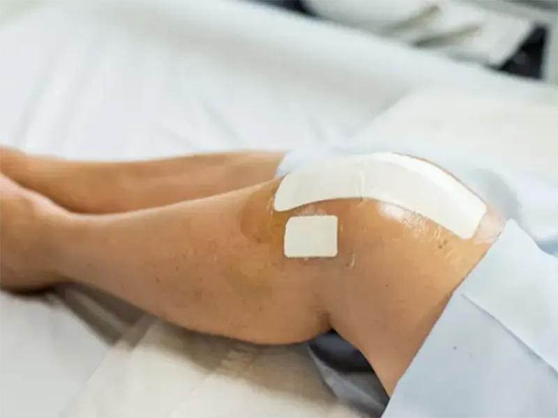 رابطه جنسی بعد از عمل تعویض مفصل زانو