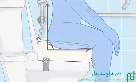 چالش های دستشویی رفتن بعد از تعویض مفصل زانو