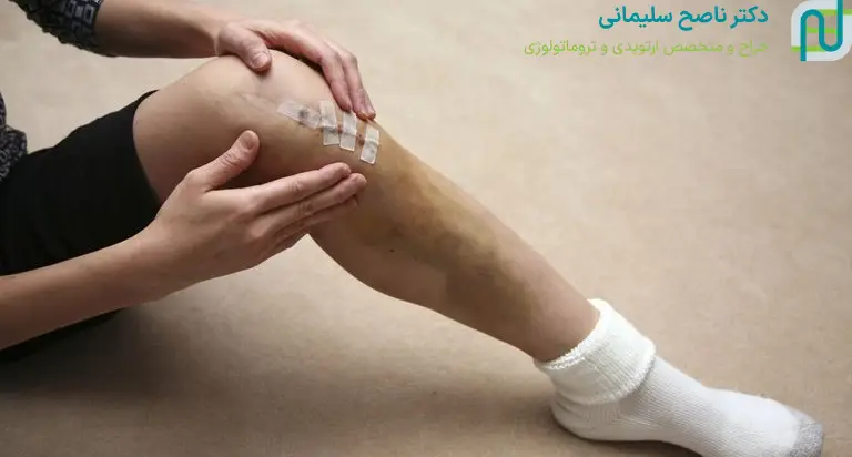 پانسمان بعد از جراحی تعویض مفصل زانو