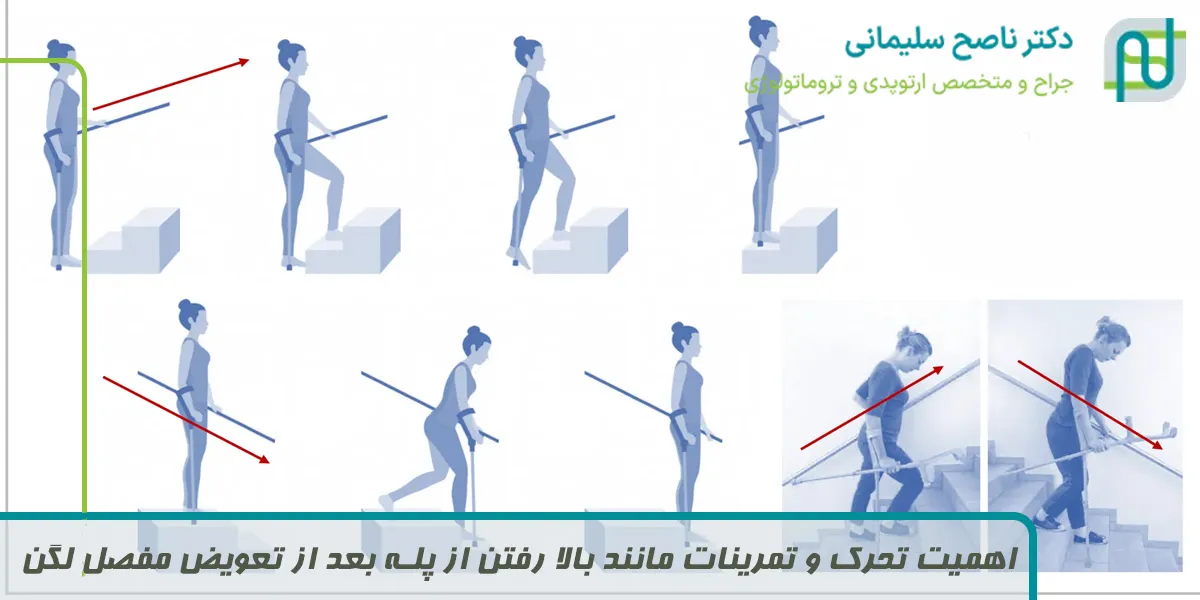 اهمیت تحرک و تمرینات مانند بالا رفتن از پله بعد از تعویض مفصل لگن