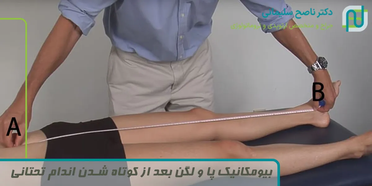 بیومکانیک پا و لگن بعد از کوتاه شدن اندام تحتانی