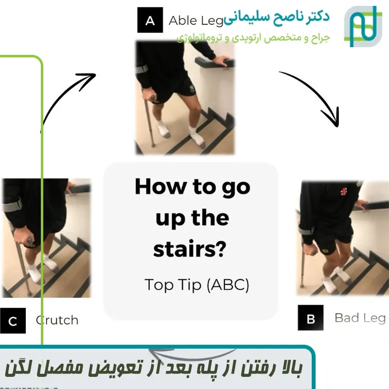 بالا رفتن از پله بعد از تعویض مفصل لگن