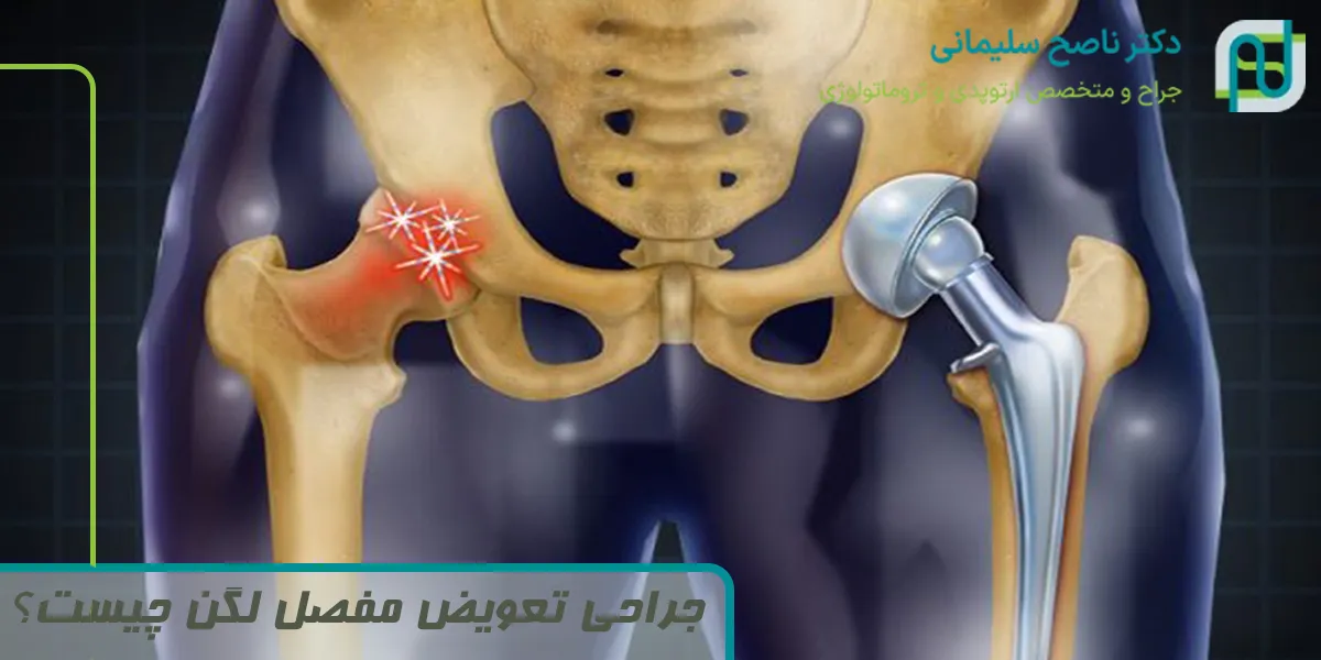 جراحی تعویض مفصل لگن چیست؟