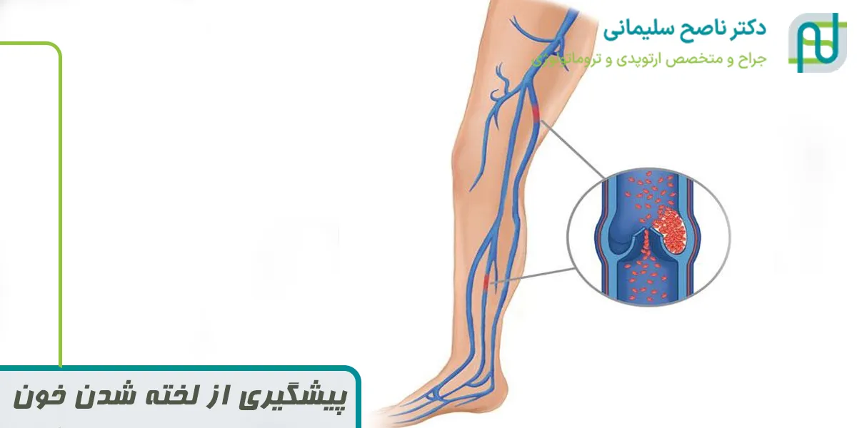 پیشگیری از لخته شدن خون
