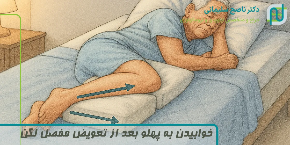 خوابیدن به پهلو بعد از تعویض مفصل لگن