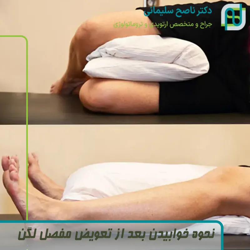 نحوه خوابیدن بعد از تعویض مفصل لگن