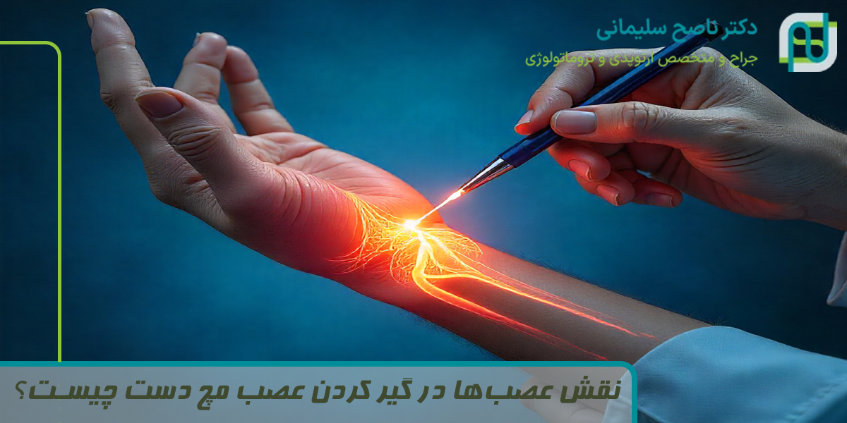 نقش عصب‌ها در گیر کردن عصب مچ دست چیست؟